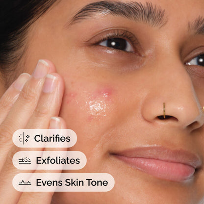 Salicylic Acid 2% Anhydrous Solution