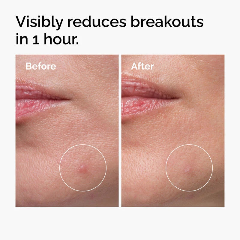 Sulfur 10% Powder to Cream Concentrate
